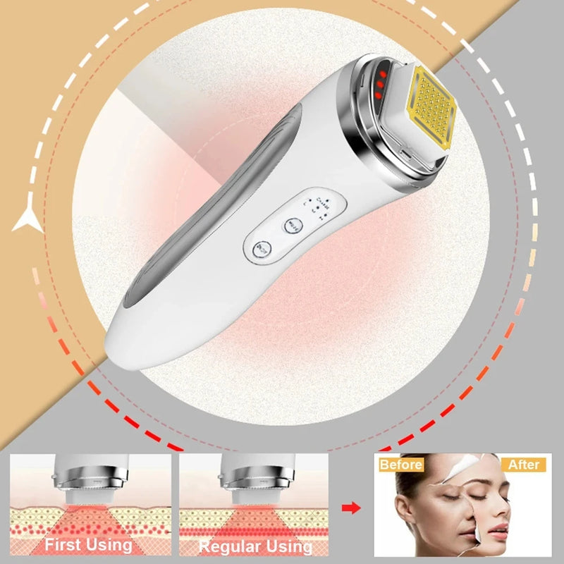 Electric Facial Lifting Machine – Skin Tightening & Wrinkle Removal