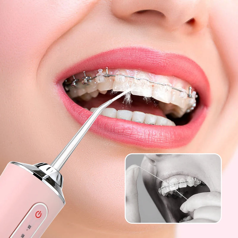 Irrigador dental portátil – Irrigador recarregável USB