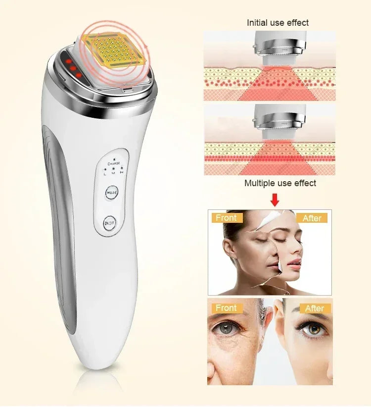 Electric Facial Lifting Machine – Skin Tightening & Wrinkle Removal