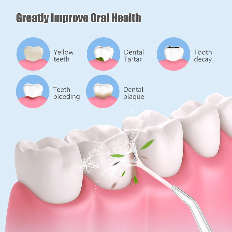 Irrigador dental portátil – Irrigador recarregável USB