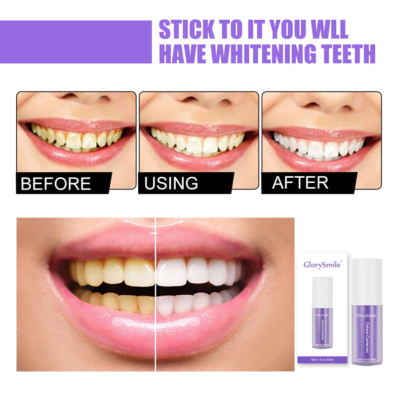 GlorySmile Whitening Toothpaste – Removes Plaque & Stains