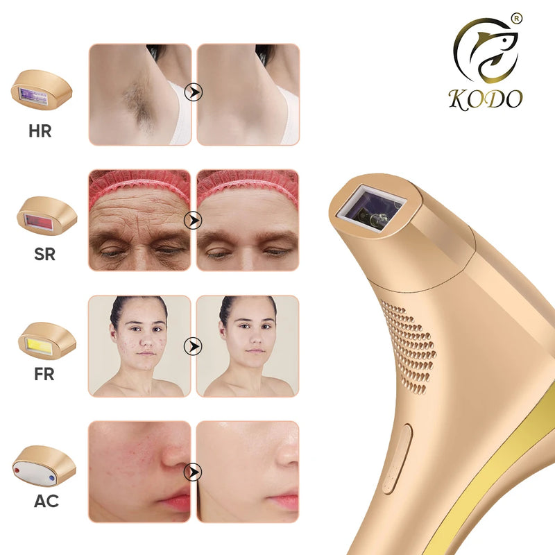 KODO IPL Laser-Haarentfernung – 4-in-1-Epilierer ohne Schmerzen für Gesicht und Körper